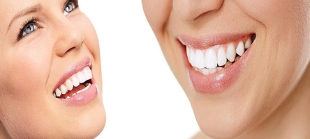 Информация за избелване на зъби 32
