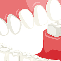 Каталог избелване на зъби 21