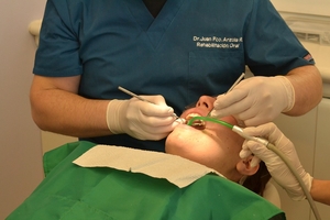 Видове зъбни импланти 11