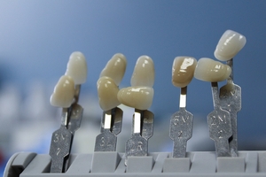 Намерете най-добрите оферти за зъбни импланти 25