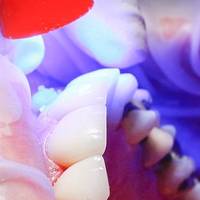 Повече за  зъбни протези 35